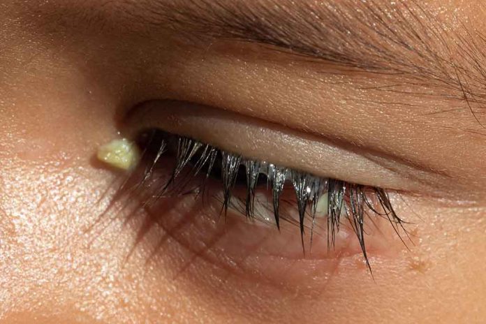 Crusty Eyes Could Be a Warning Sign for These Diseases