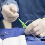 Medical professional preparing an intravenous catheter in a sterile setting