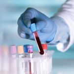MASSIVE Trial Results Shock Cancer Experts Gloved hand holding a blood sample test tube.