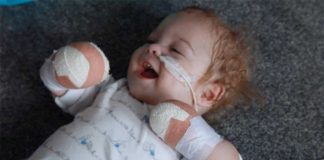 Baby Loses Limbs After Developing Sepsis